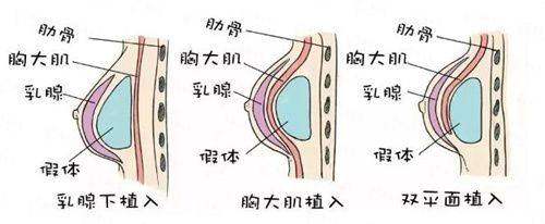 四、<strong>北京嘉禾整形找高红艳怎么预约更方便?</strong>