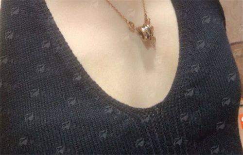 二、<strong>李保楷在浙江杭州清锴医疗美容门诊部的技术风格与价格</strong>