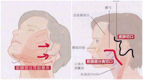 四、<strong>北京俊泰美好医疗美容门诊薛志强如何预约面诊</strong>