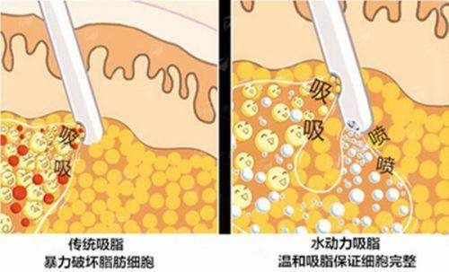 <strong>二、成都西区整形医院杨世界的执业理念和技术特点</strong>