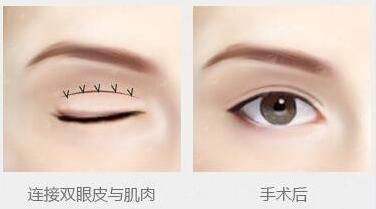 二、<strong>广州军美整形医院王世虎擅长哪些医美项目</strong>