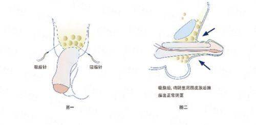 二、<strong>西安国际医学整形医院孙峰的专精成就与临床成绩</strong>