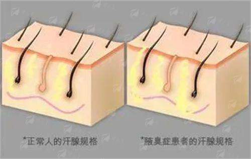 <strong>三、深圳艺星医疗美容医院牛克辉做鼻整形价格是多少</strong>