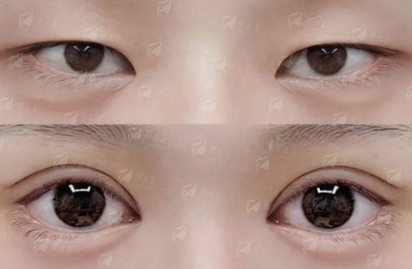 二、<strong>成都军大整形美容医院李辉做项目价格怎么样?</strong>