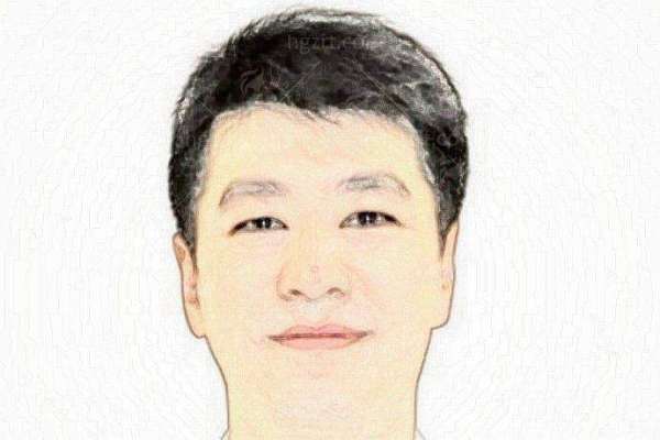 鞍山燕丽美容医院张磊假体隆鼻案例风格优势-上新颜智尚小程序预约