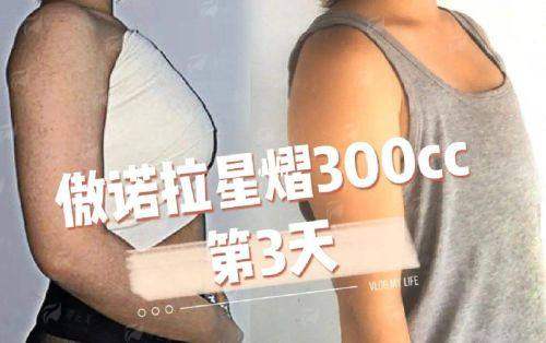 五、鞍山张玉霞星范实例分享与术后护理要点
