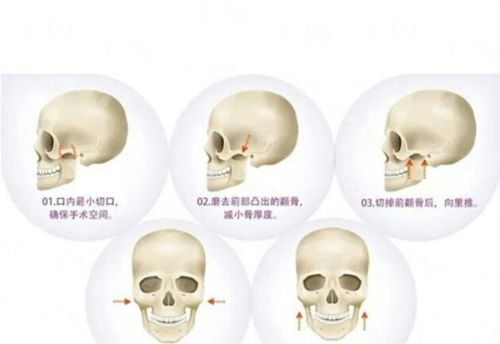 五、鞍山张玉霞星范医疗美容门诊价格参考与预约指南