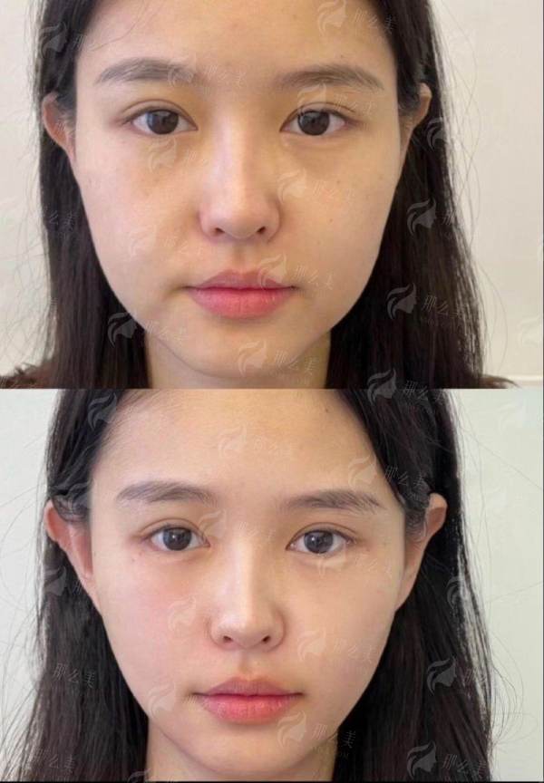 
成都素美白振华面部线雕价格贵吗？医生技术风格攻略，新颜智尚小程序查找指南一键get