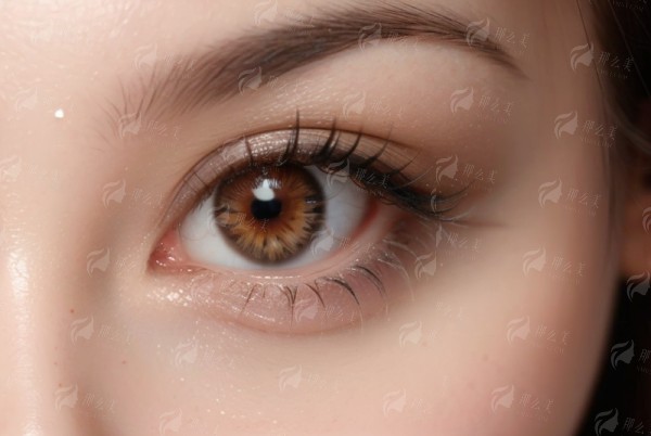 二、半飞秒近视手术：原理与优势解析