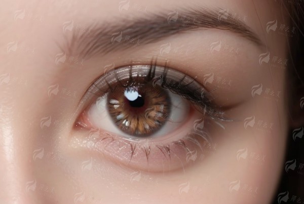 一、呼和浩特晶体植入手术为什么选光正眼科?