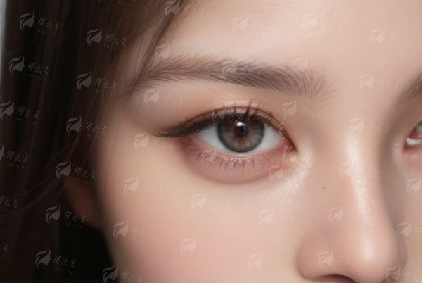 四、扬州艾菲斯双眼皮项目为何受青睐？