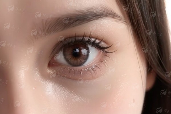 三、厦门慕一王海涛医生双眼皮实例大揭秘