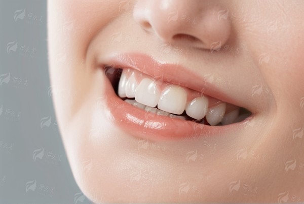 四、中山松鼠口腔种植牙，服务体验怎么样？