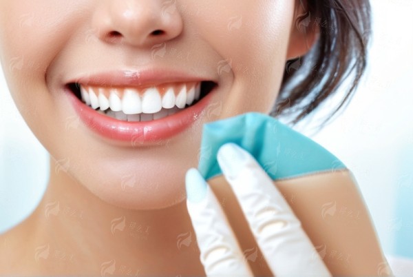 四、韩国登腾种植体在绍兴嵊州口腔的成功实例分享