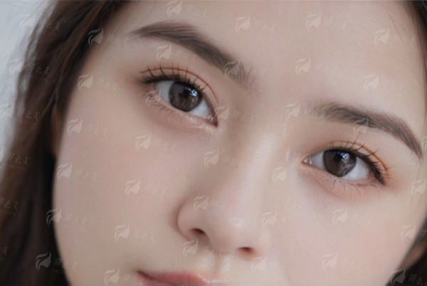 三、乌鲁木齐慧美医疗美容的祛眼袋价格及预约方式